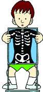 x-ray showing bones of a child